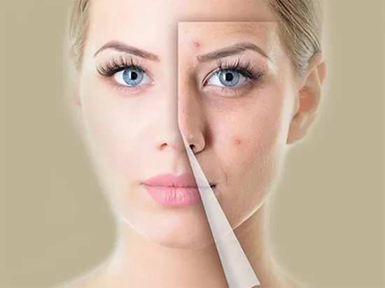 1A Guide to Taking Advantage of Special Opportunities in the Beauty World